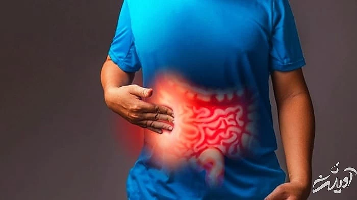 مشکلات روده